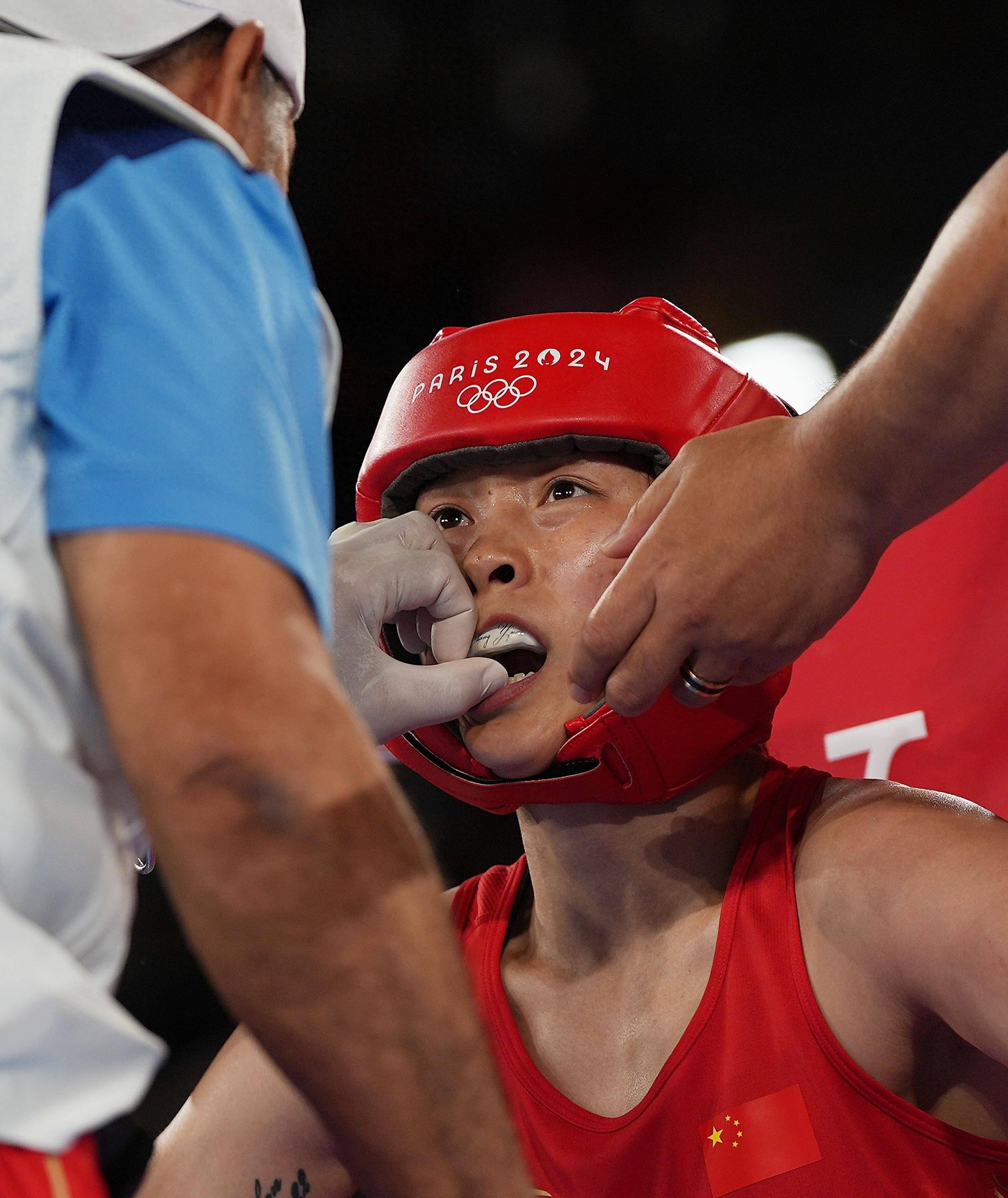 拳击选手激烈对决,技高功深 拳击选手激烈对决,技高功深